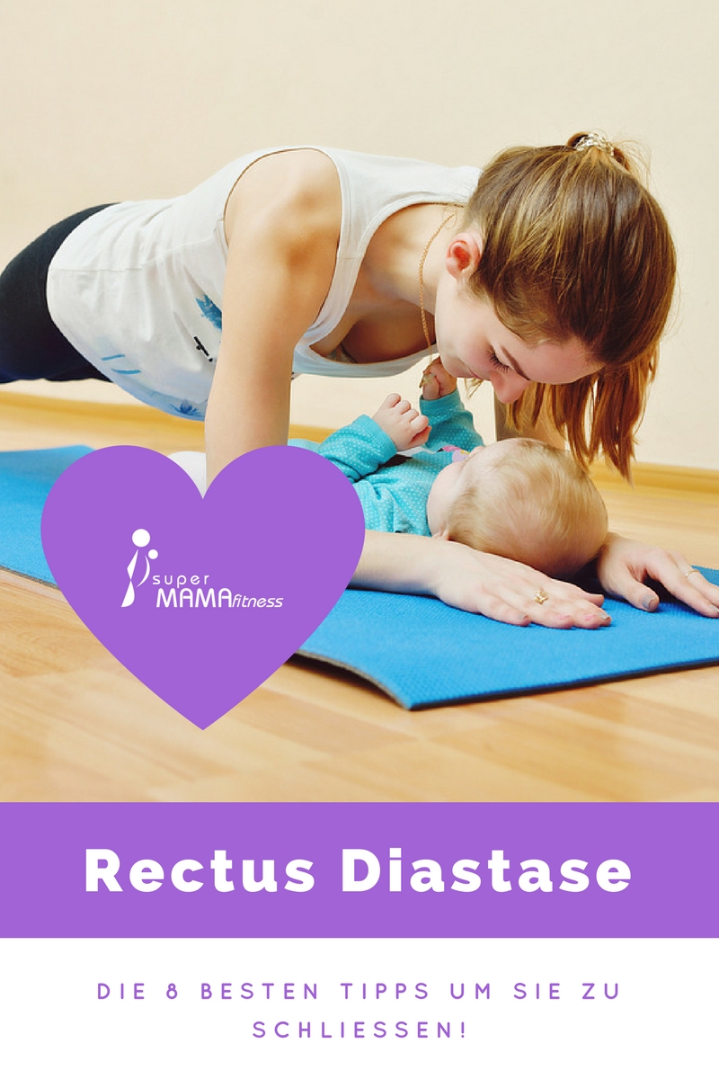 Eine Rectus Diastase ist nicht schön, aber man kann sie meißtens wieder schließen.