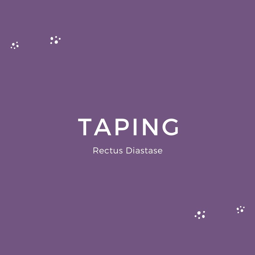 Taping Rectus Diastase